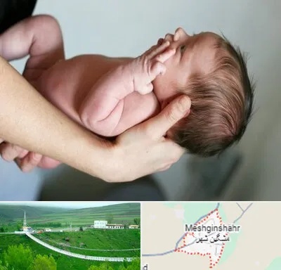 درمان نازایی در مشگین شهر