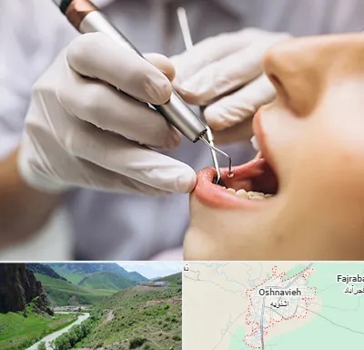دندانپزشکی ارزان در اشنویه