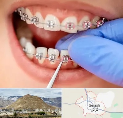 مرکز ارتودنسی دندان در گراش