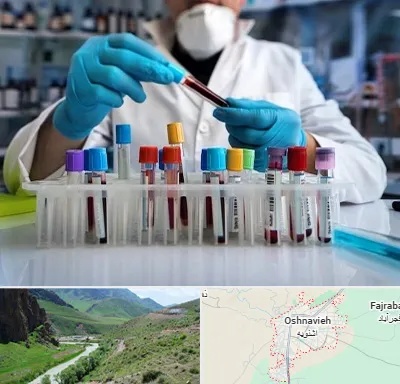 آزمایشگاه خون در اشنویه