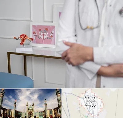 دکتر سرطان تخمدان در آران و بیدگل