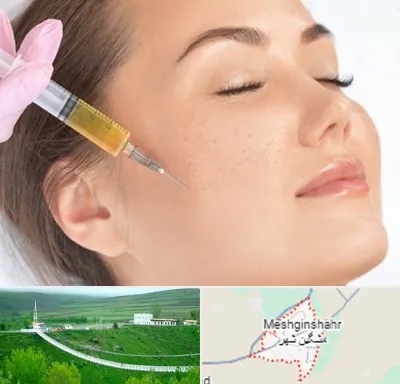 آموزش تزریق ژل و بوتاکس در مشگین شهر