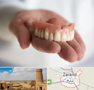 لیفت لثه با لیزر در زرند