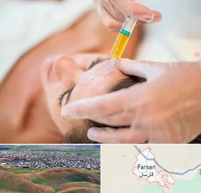 پی آر پی در فارسان