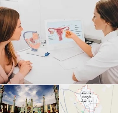 فوق تخصص نازایی در آران و بیدگل
