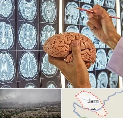دکتر فوق تخصص جراح مغز و اعصاب در جم