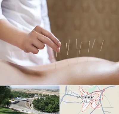 درای نیدلینگ در مبارکه