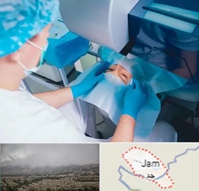 دکتر عمل لازک چشم در جم