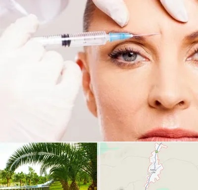 مزوژل در کهنوج