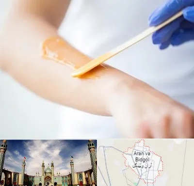 اپیلاسیون کار در آران و بیدگل
