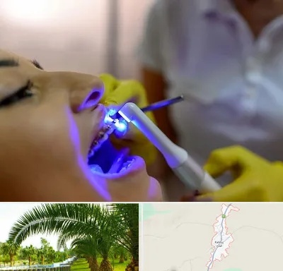 دندانپزشکی با لیزر در کهنوج