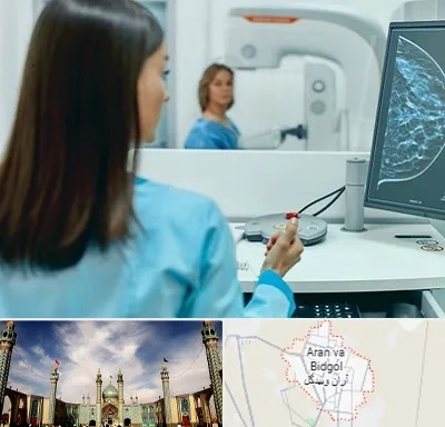 ماموگرافی در آران و بیدگل