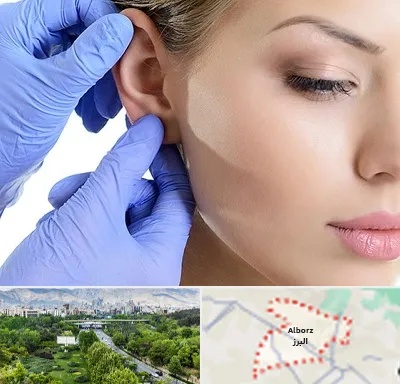 اتوپلاستی در البرز