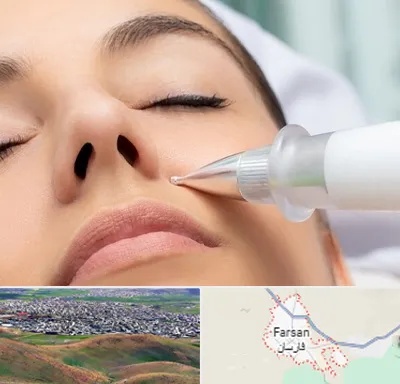 پلاسما جت بینی در فارسان