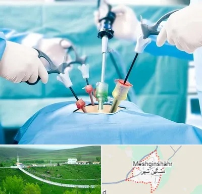 دکتر لاپاراسکوپی در مشگین شهر