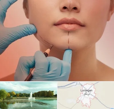 دکتر زیبایی خانم در لردگان