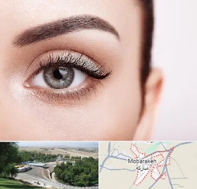 فوق تخصص عنبیه در مبارکه