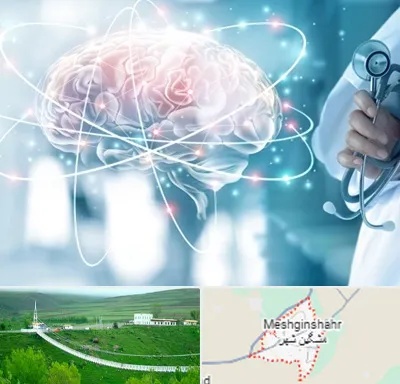 دکتر سکته مغزی در مشگین شهر