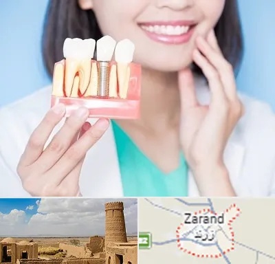 متخصص ایمپلنت در زرند