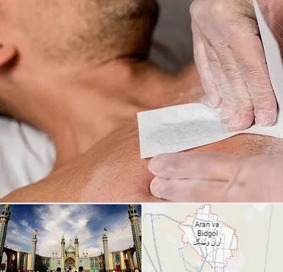 اپیلاسیون آقایان در آران و بیدگل
