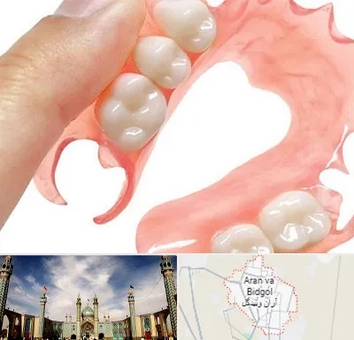 پروتز متحرک دندان در آران و بیدگل