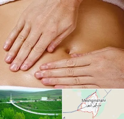 متخصص ناف گیری در مشگین شهر