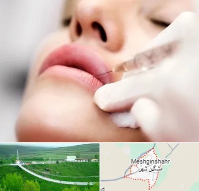 کلینیک تزریق ژل لب در مشگین شهر
