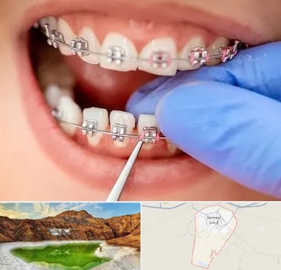 مرکز ارتودنسی دندان در گرمسار