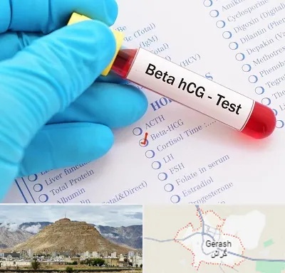 آزمایشگاه بارداری در گراش