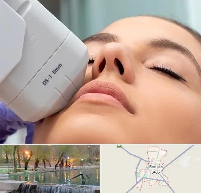 هایفوتراپی در بروجن