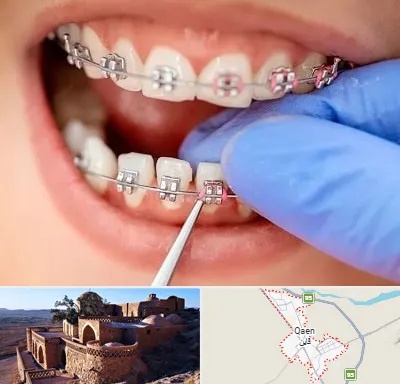 مرکز ارتودنسی دندان در قائن
