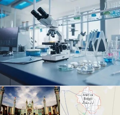 آزمایشگاه زگیل تناسلی در آران و بیدگل