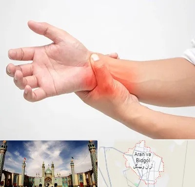دکتر متخصص دست در آران و بیدگل