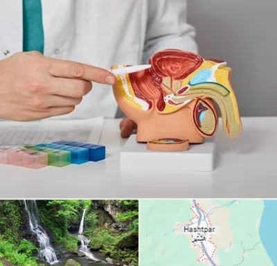 دکتر اورولوژی در هشتپر