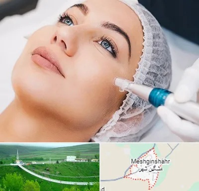 مزونیدلینگ در مشگین شهر