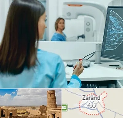 ماموگرافی در زرند
