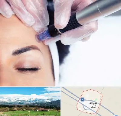 کلینیک مزوتراپی صورت در آبیک