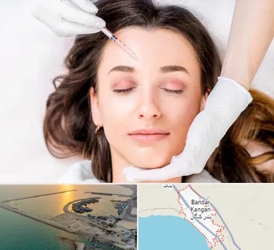 مزوتراپی ابرو در بندر کنگان