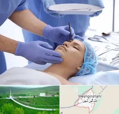 عمل بینی طبیعی در مشگین شهر