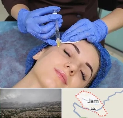 تزریق پروفایلو در جم