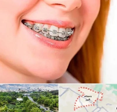 ارتودنسی ارزان در البرز