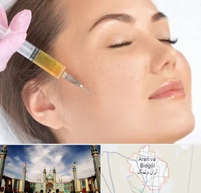 آموزش تزریق ژل و بوتاکس در آران و بیدگل