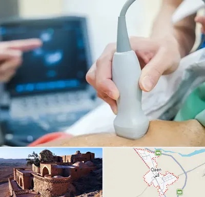 اکو قلب شبانه روزی در قائن