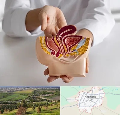 دکتر دستگاه تناسلی مردان در نقده