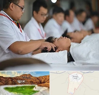 طب چینی در گرمسار