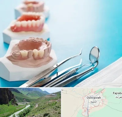متخصص روکش دندان در اشنویه
