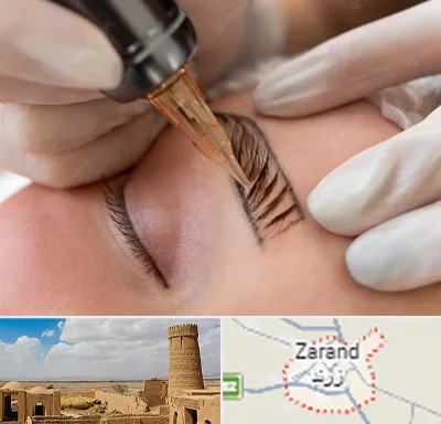 میکروبلیدینگ در زرند