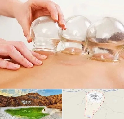 بادکش درمانی در گرمسار