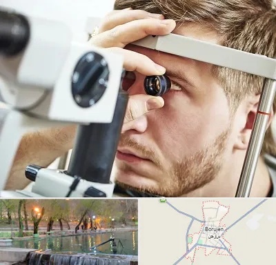 فوق تخصص قرنیه در بروجن