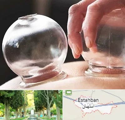 مرکز حجامت در استهبان